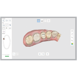 Escaner Intraoral Medit i500